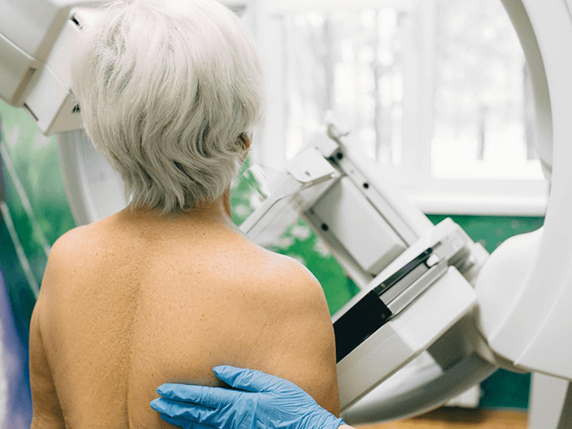 Does Medicare Cover Mammograms ClearMatch Medicare does-medicare-cover-mammograms-clearmatch-medicare