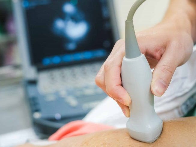 Does Medicare Cover an Echocardiogram
