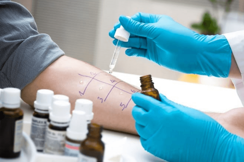 Does Medicare Cover Allergy Testing? | ClearMatch Medicare