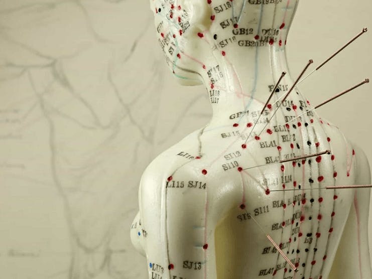 Does Medicare Cover Acupuncture