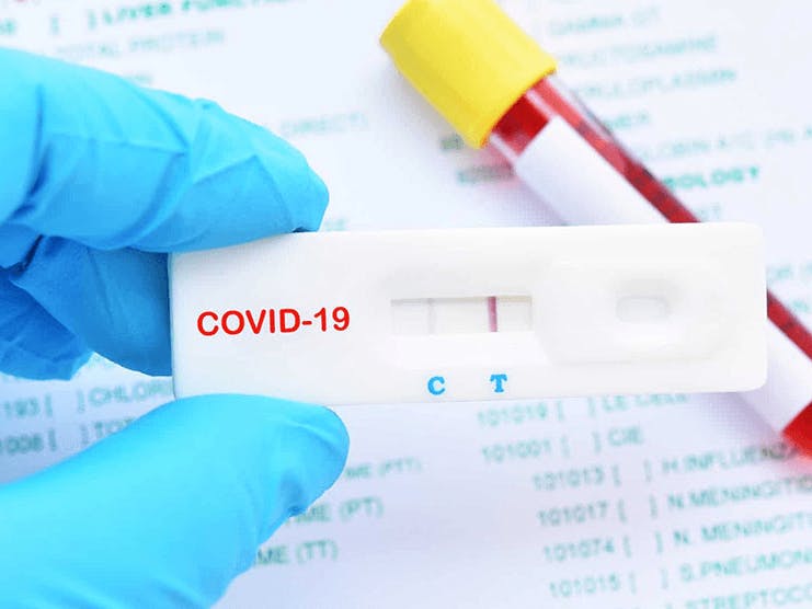 Does Medicare Cover COVID Testing?