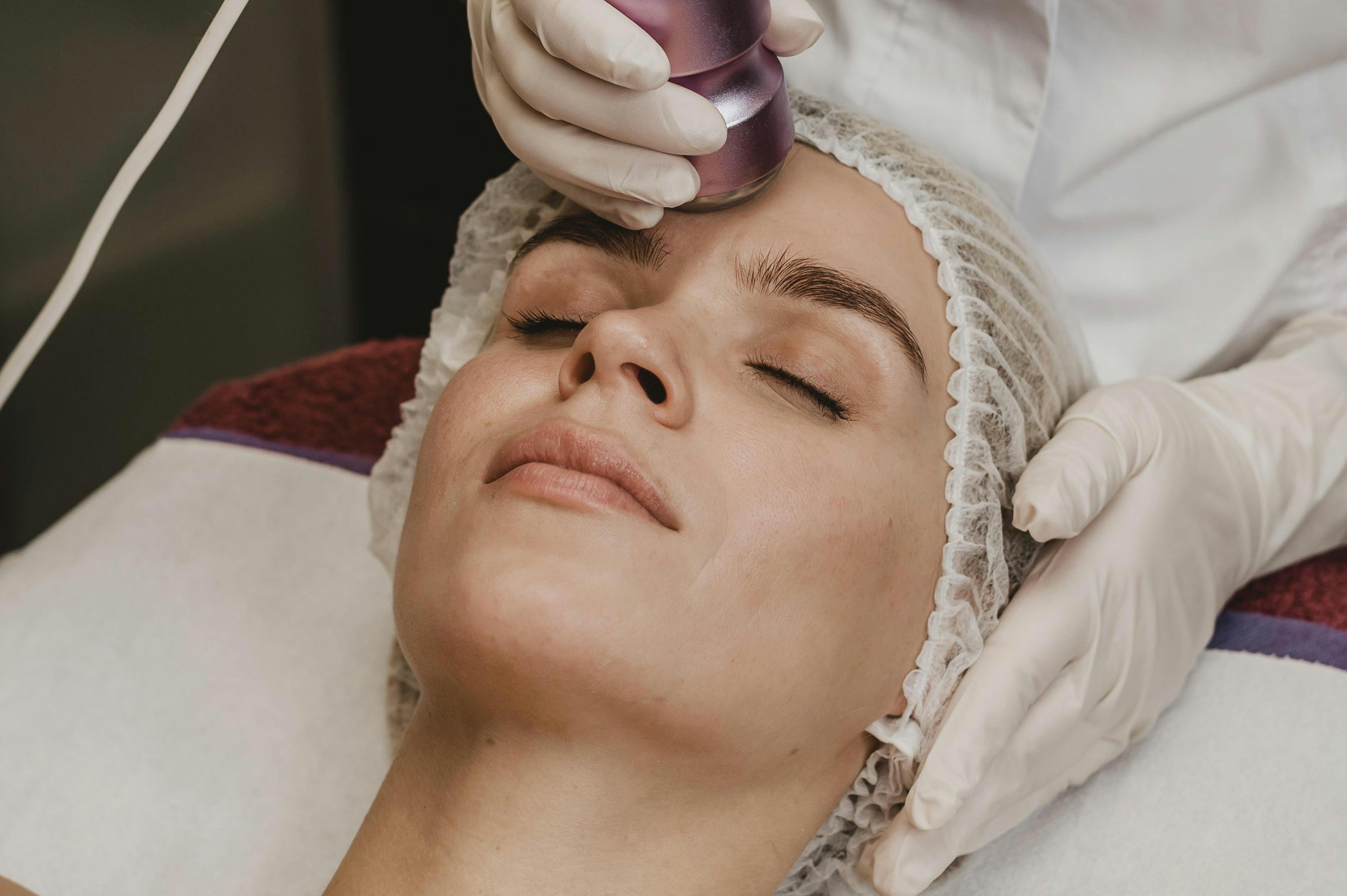 A female patient receiving aesthetic laser treatment
