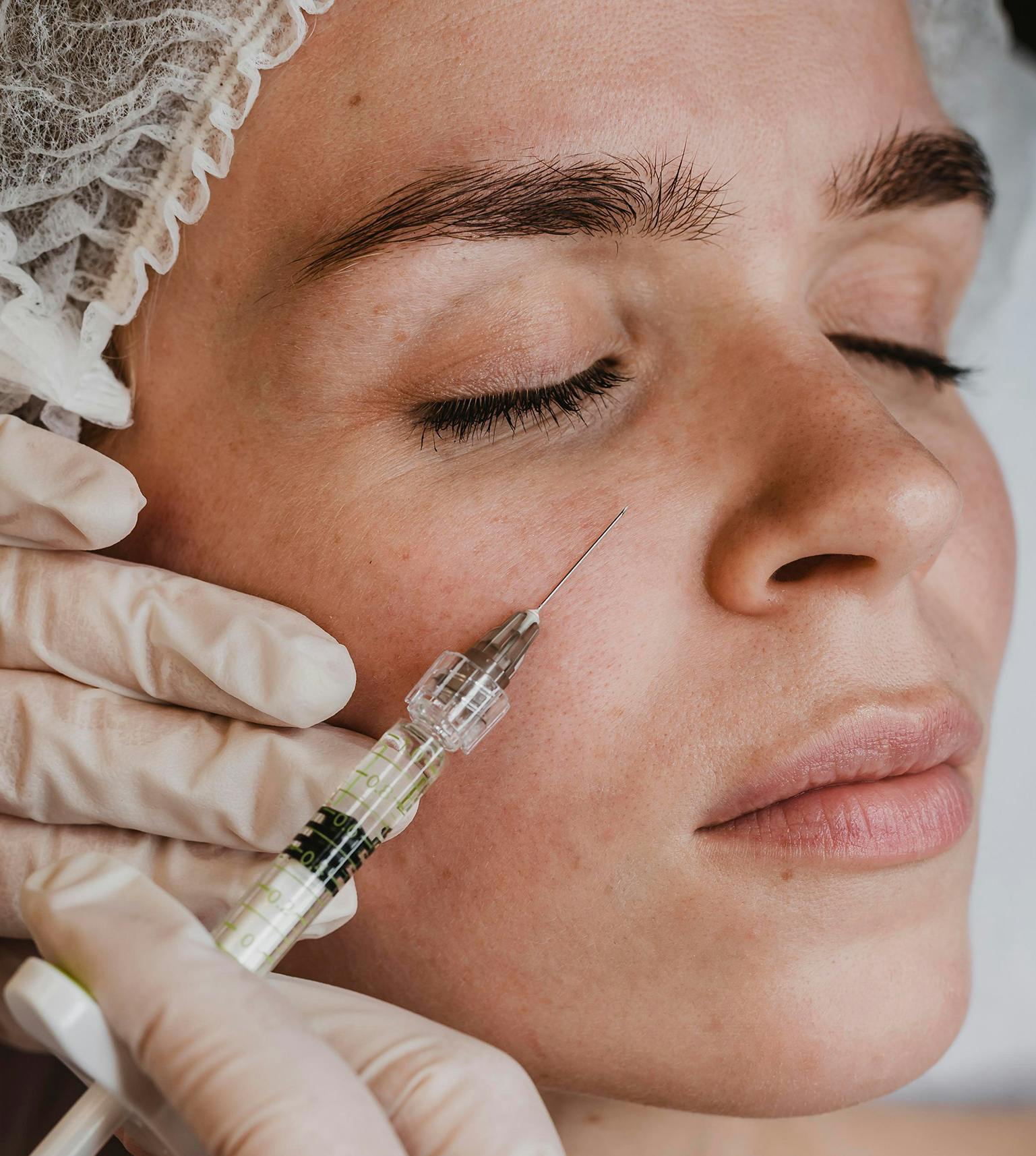 A female patient having tear trough treatment