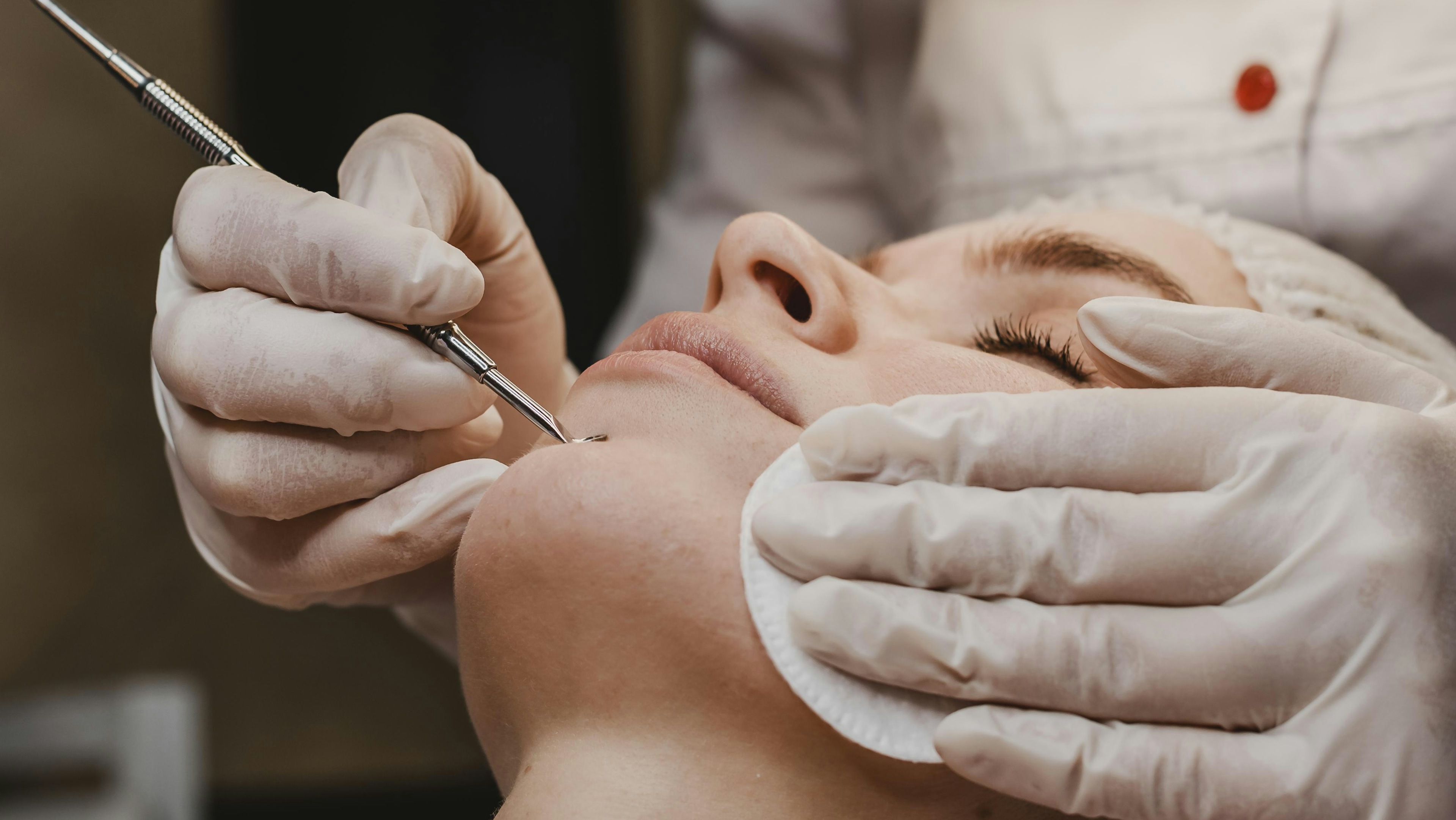 A female patient receiving Dermaplaning treatment
