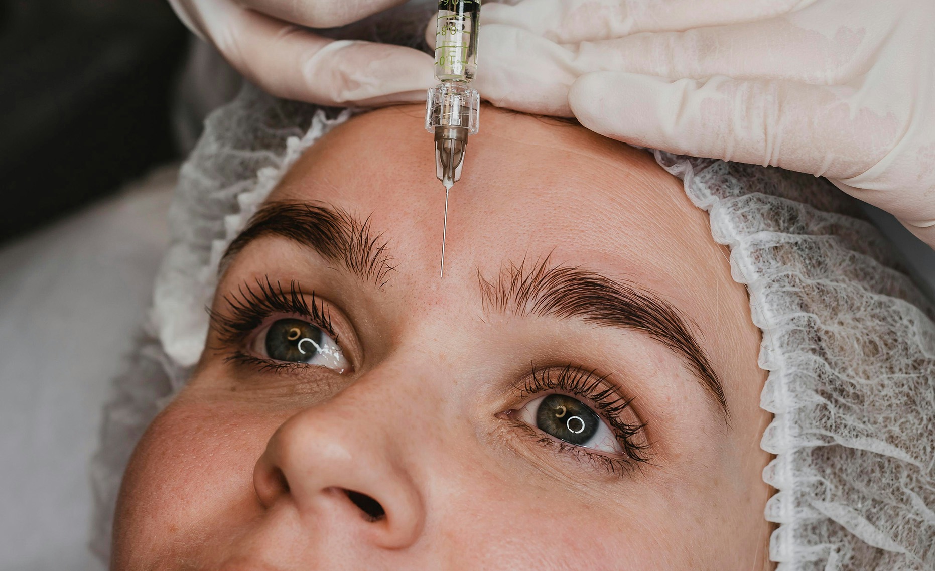 A woman having anti-wrinkle treatment