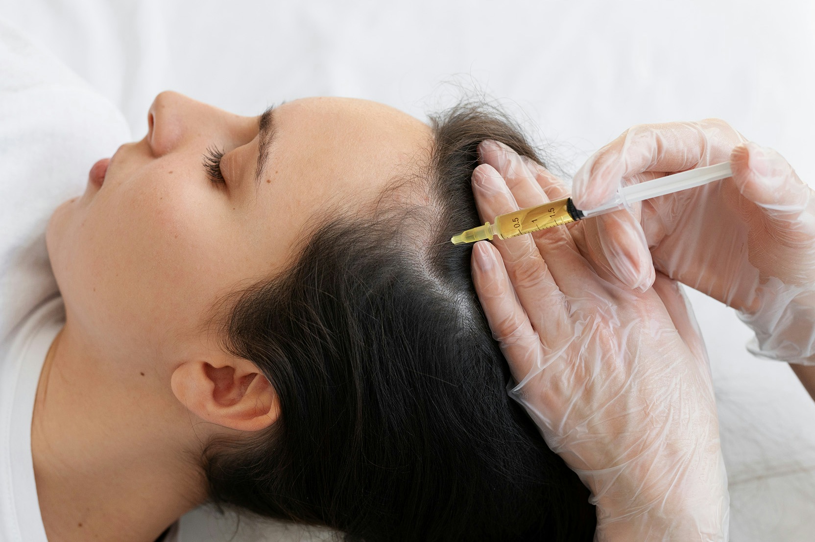 A female patient receiving PRP treatment