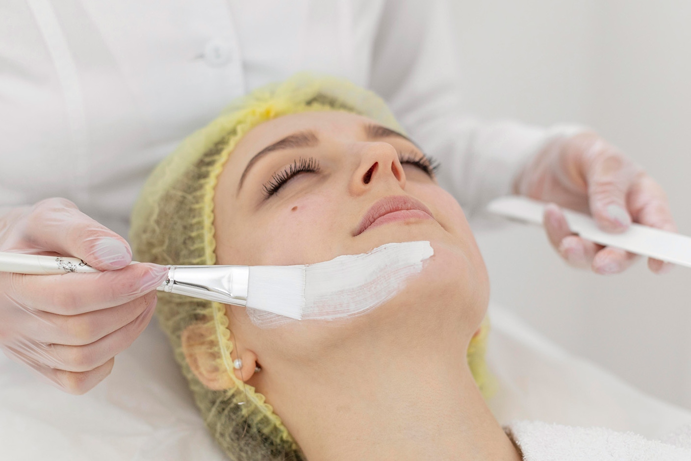 A woman having Perfect Peel treatment