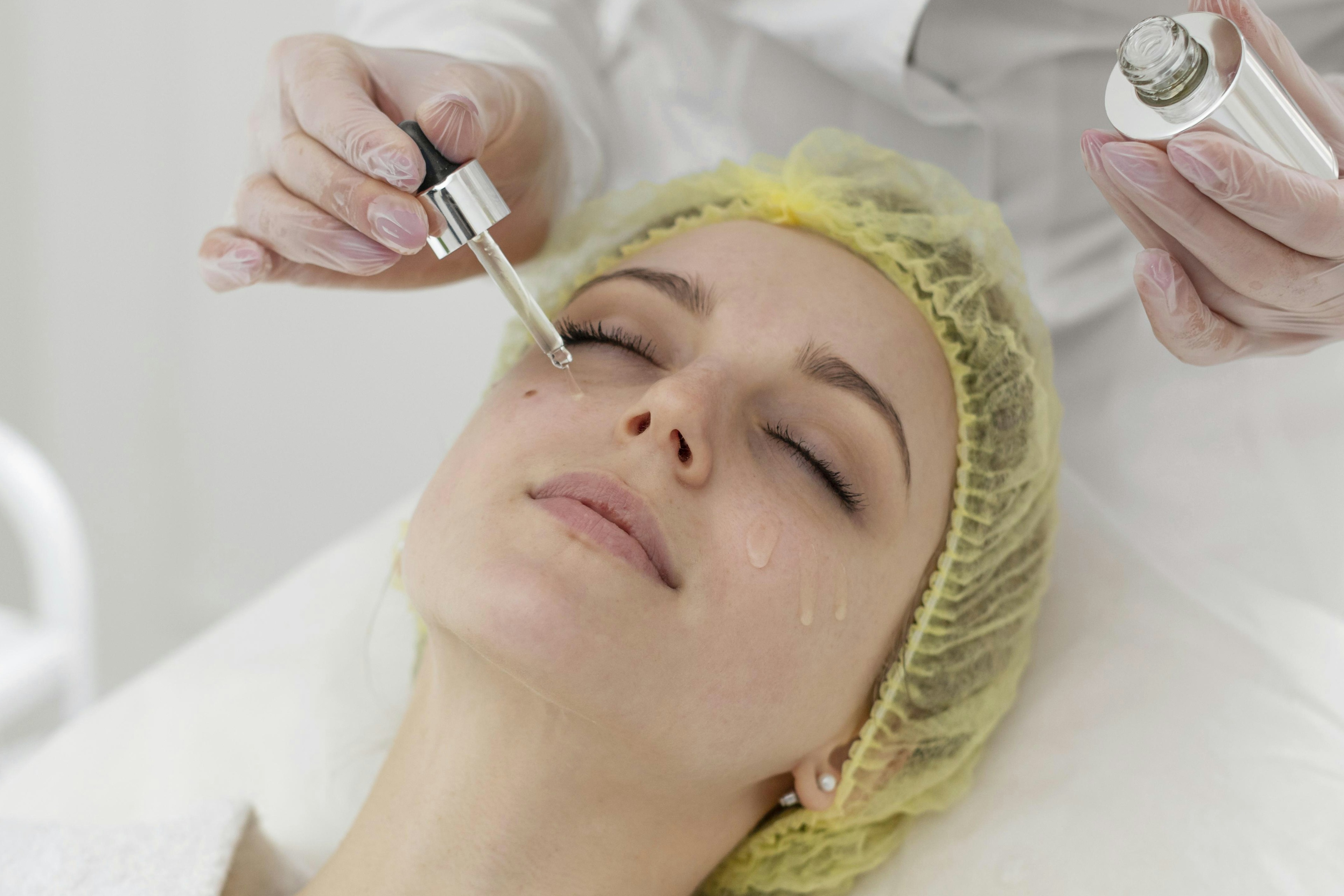A female patient receiving BioRePeel treatment