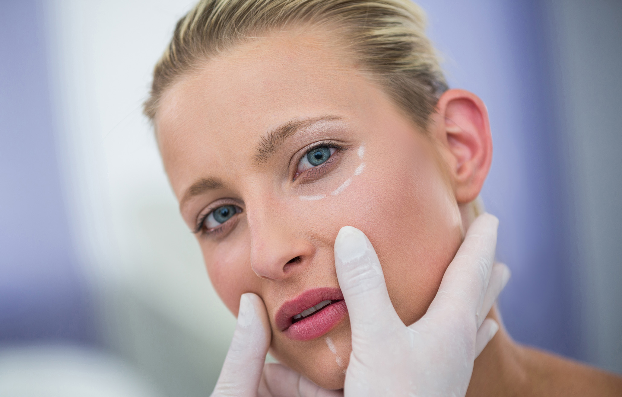 A woman having tear trough treatment