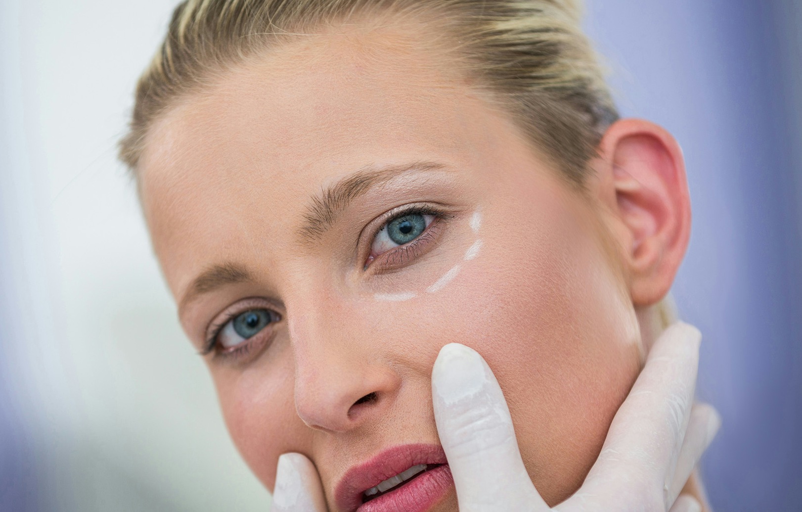 A woman having tear trough treatment