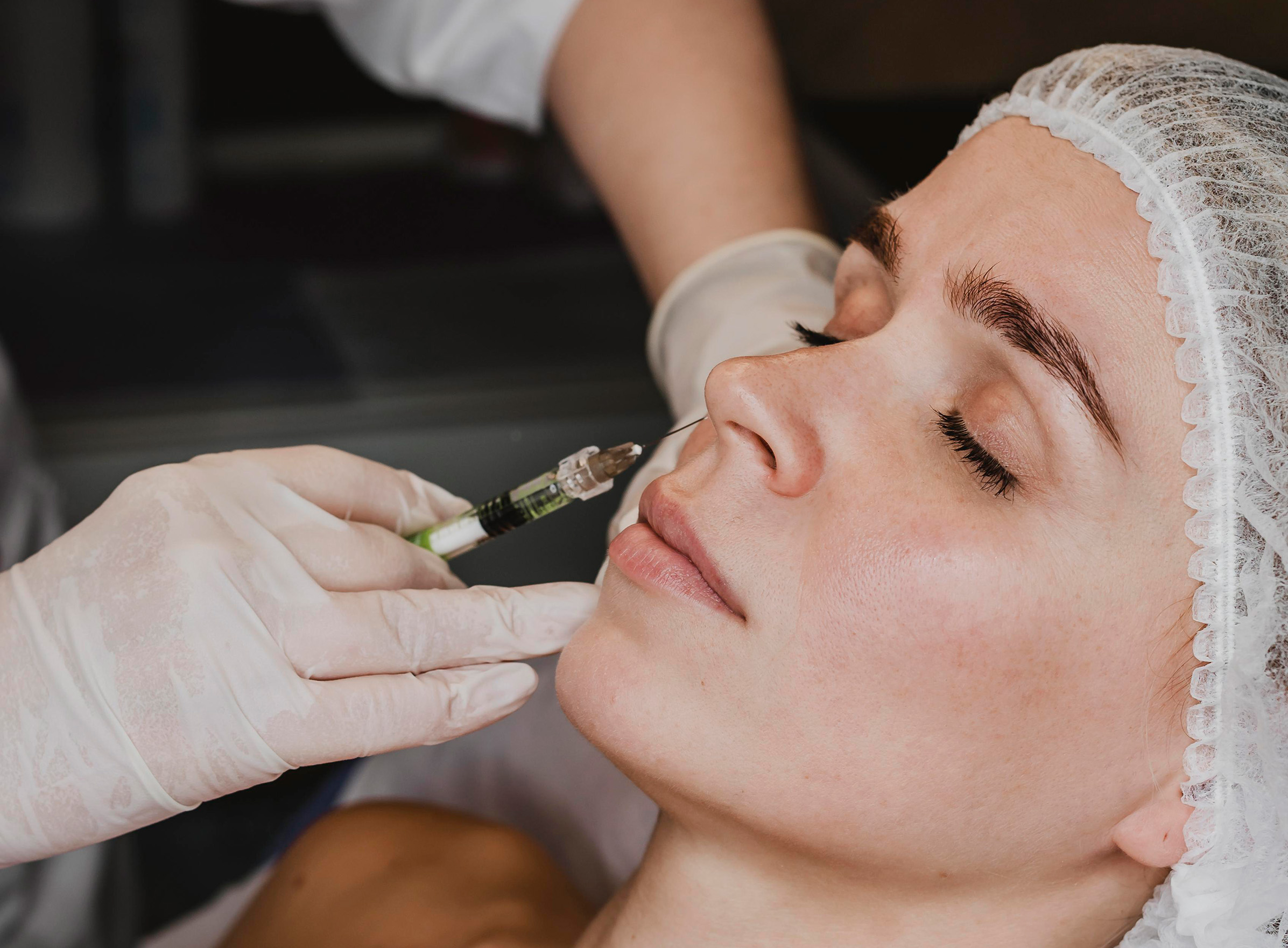 A woman having Profhilo treatment