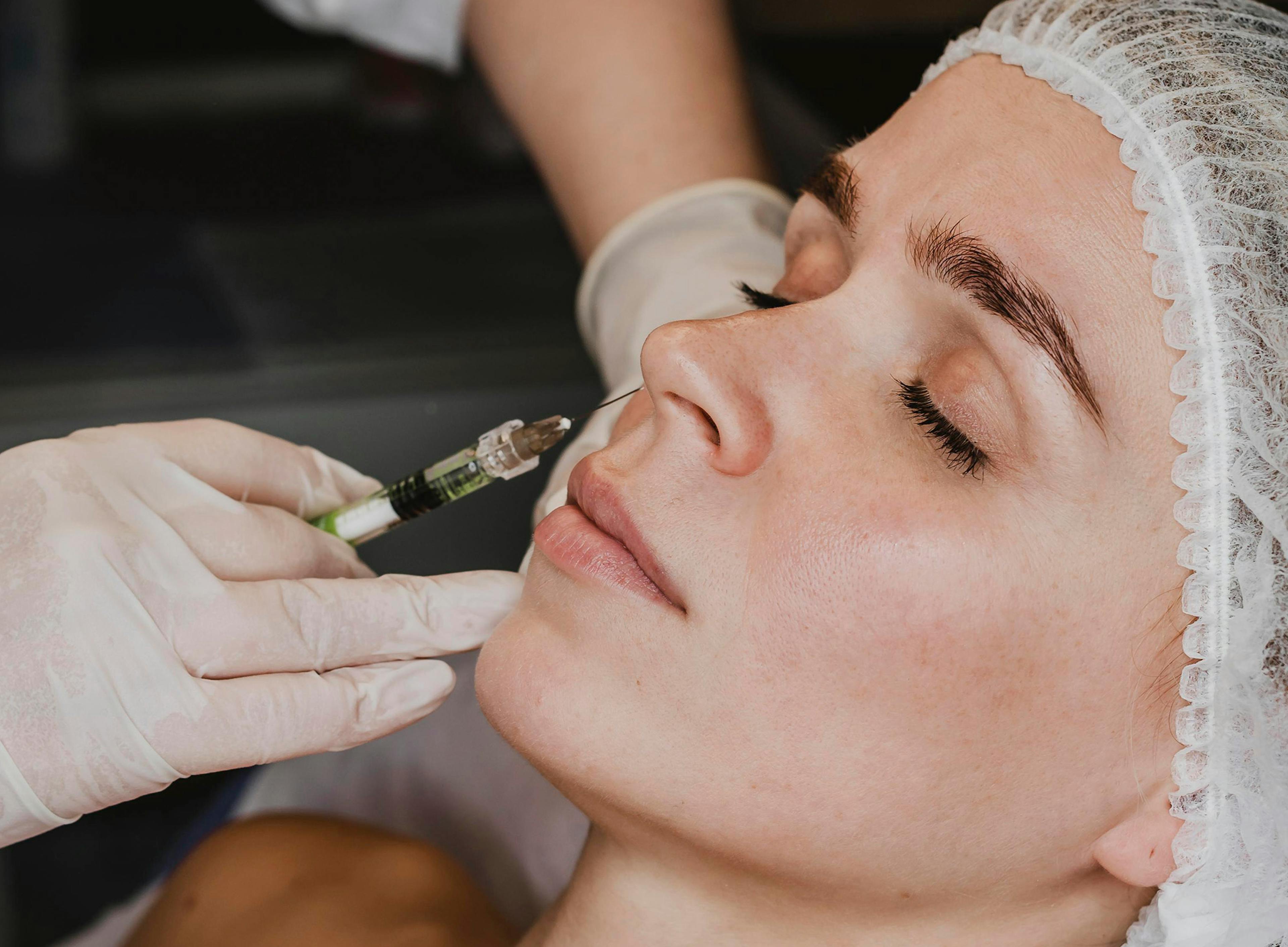 A female patient receiving Profhilo treatment