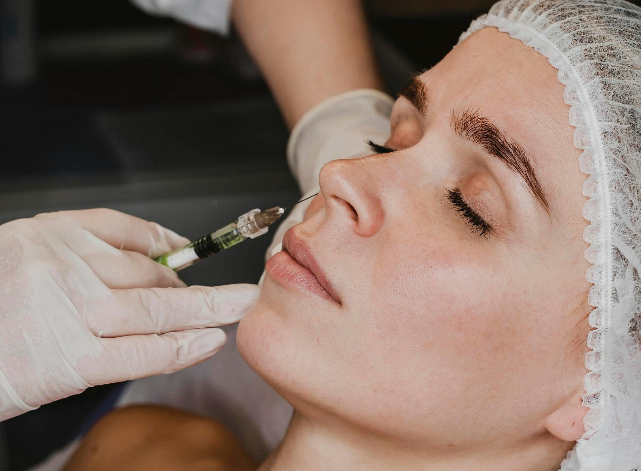 A female patient receiving Profhilo treatment