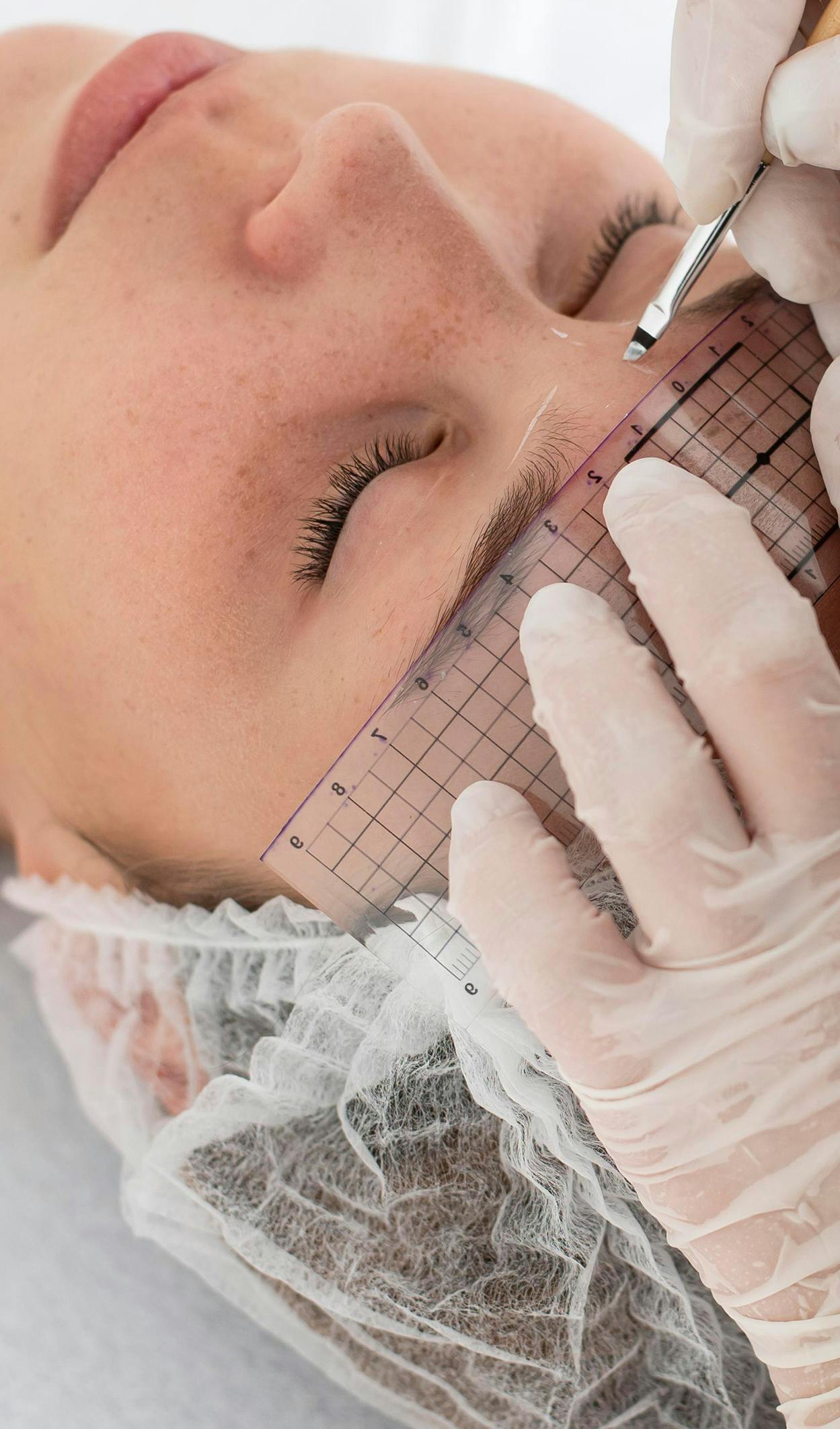 Advanced dermal filler training on a woman