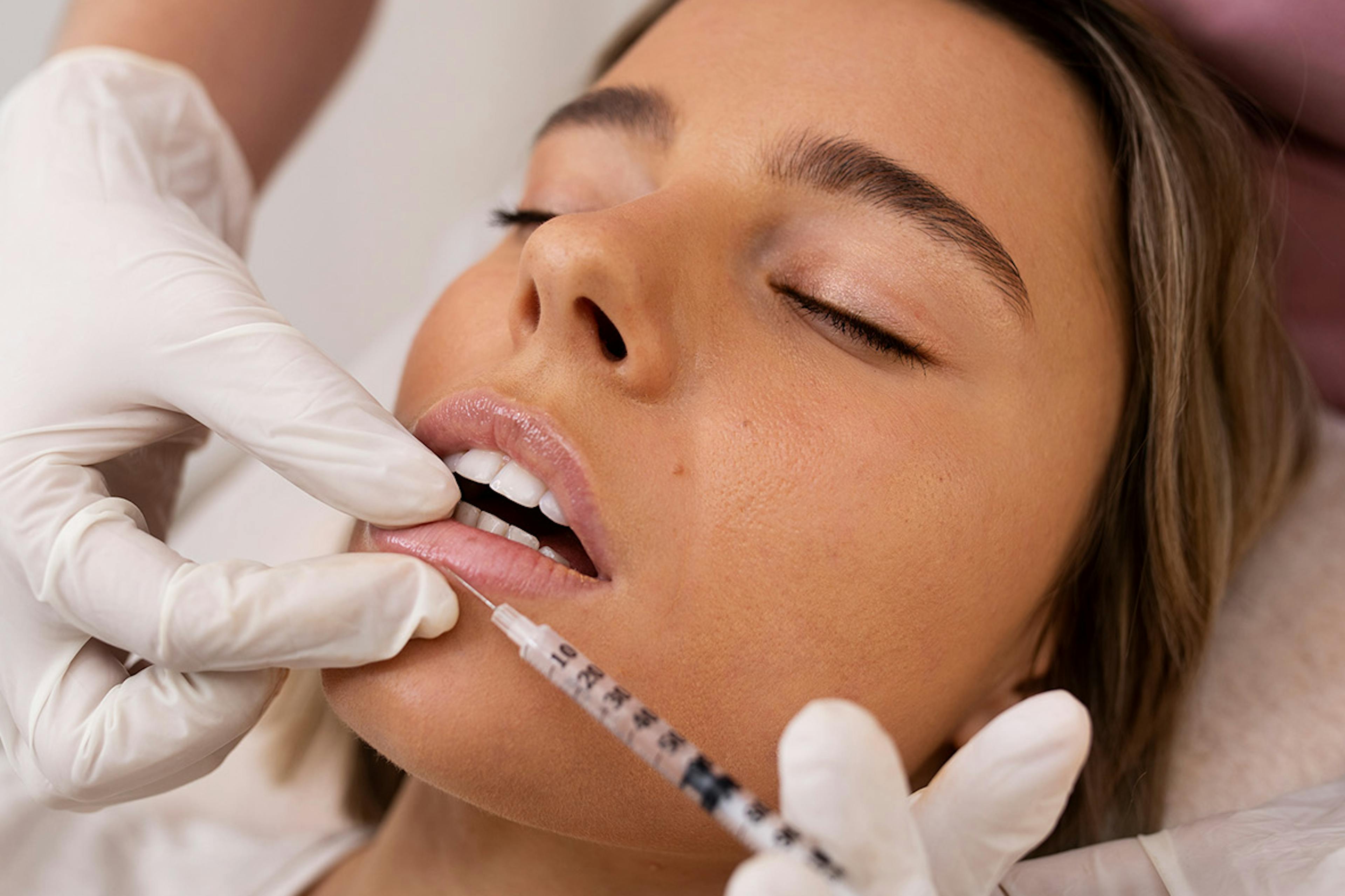 A female patient receiving lip filler treatment