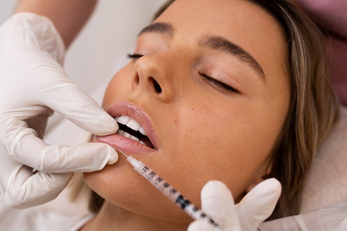A female patient receiving lip filler treatment