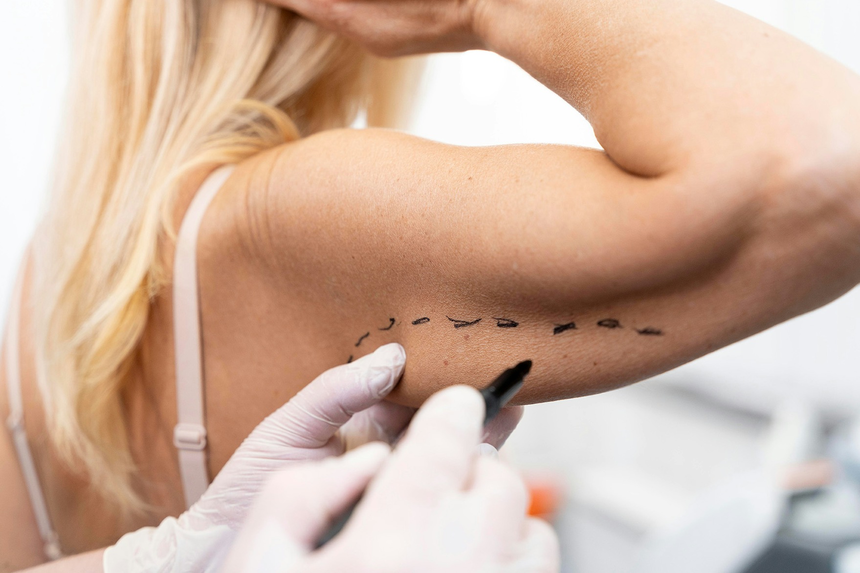 woman having arm slimming botox treatment