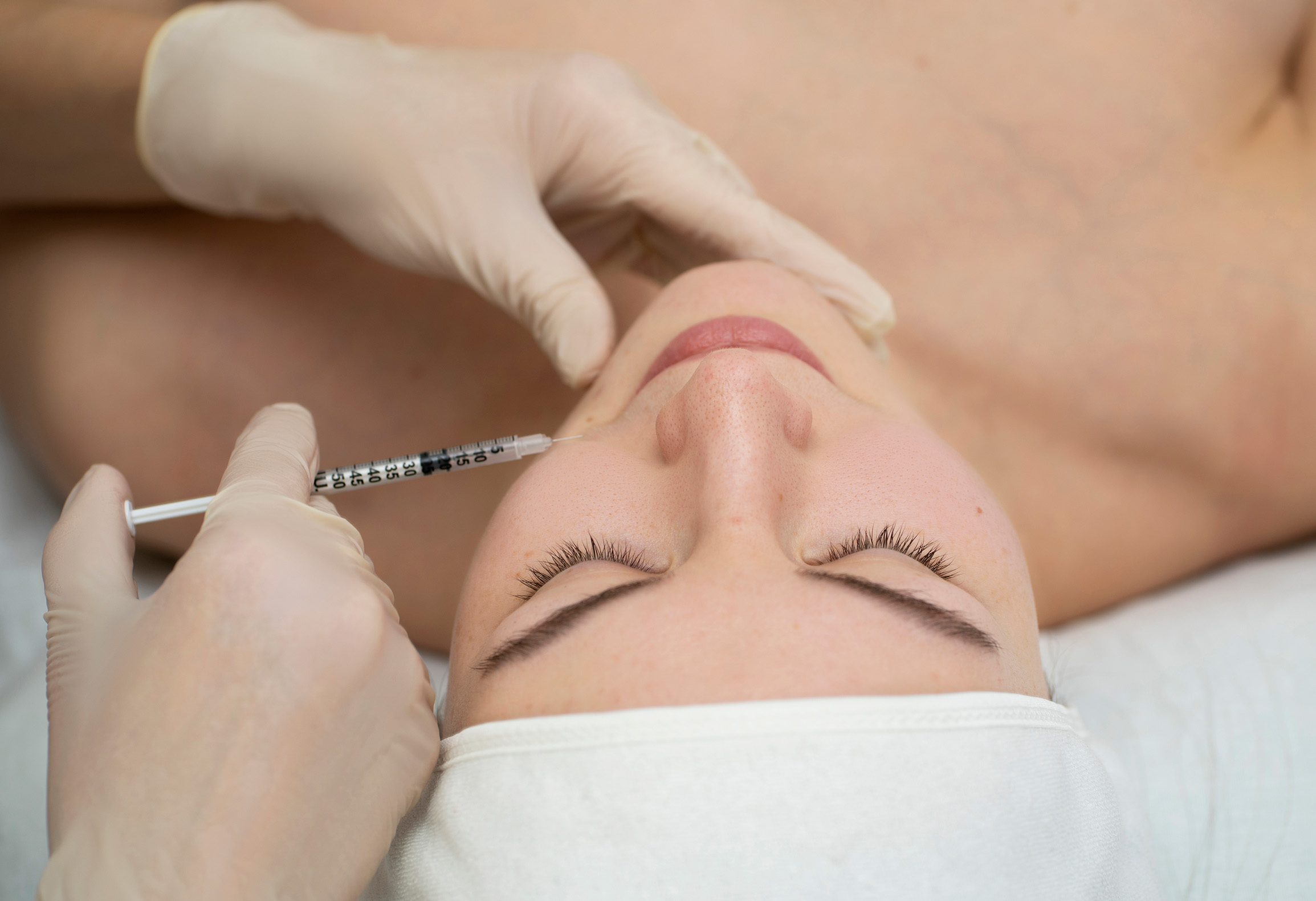 woman getting radiesse treatment