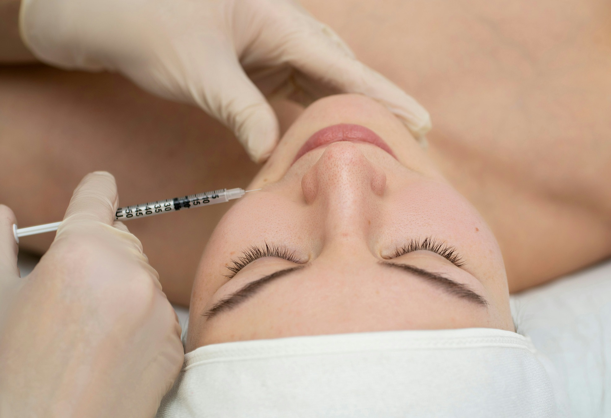 woman getting radiesse treatment