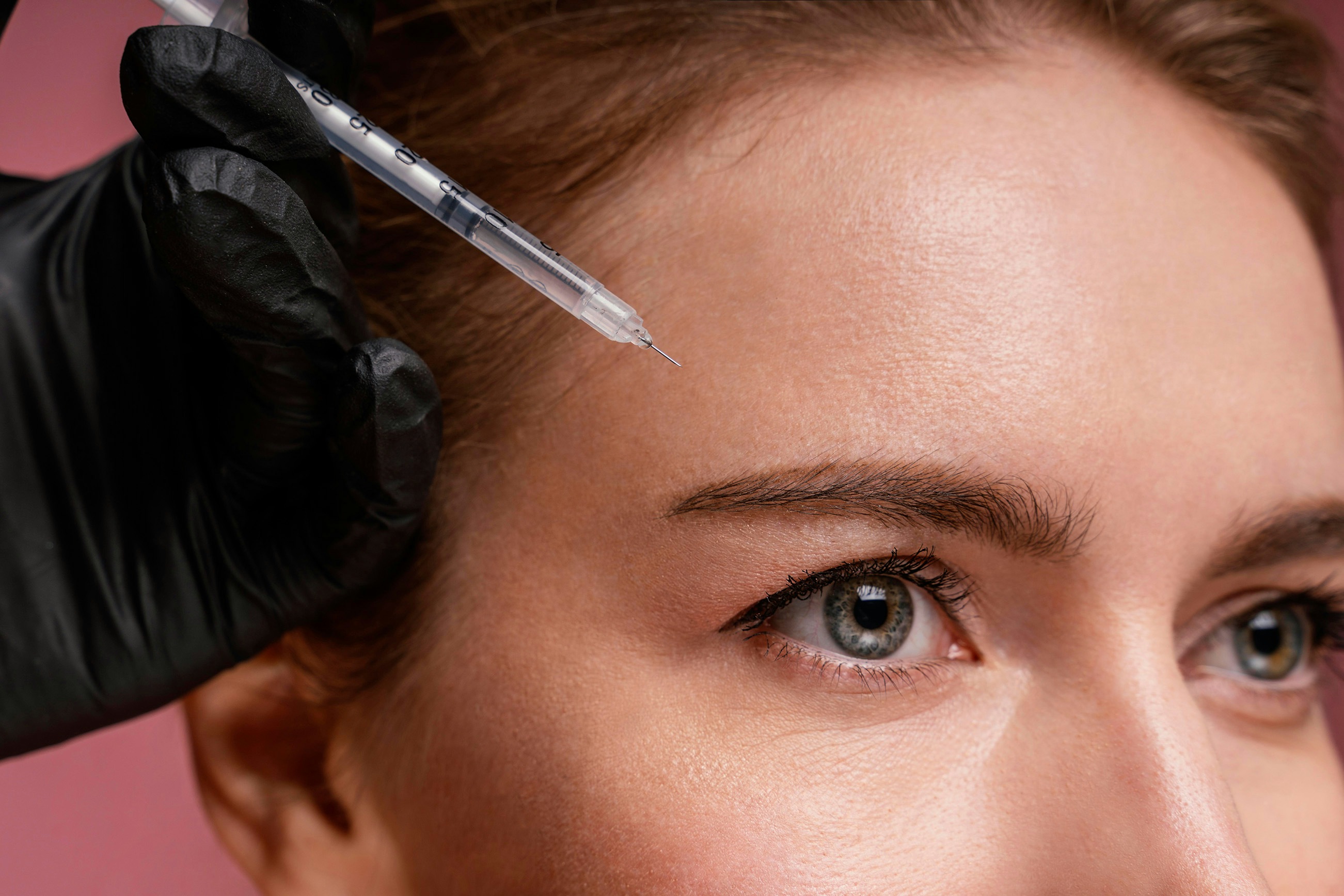 A female patient receiving Restylane Vital injection in her forehead region