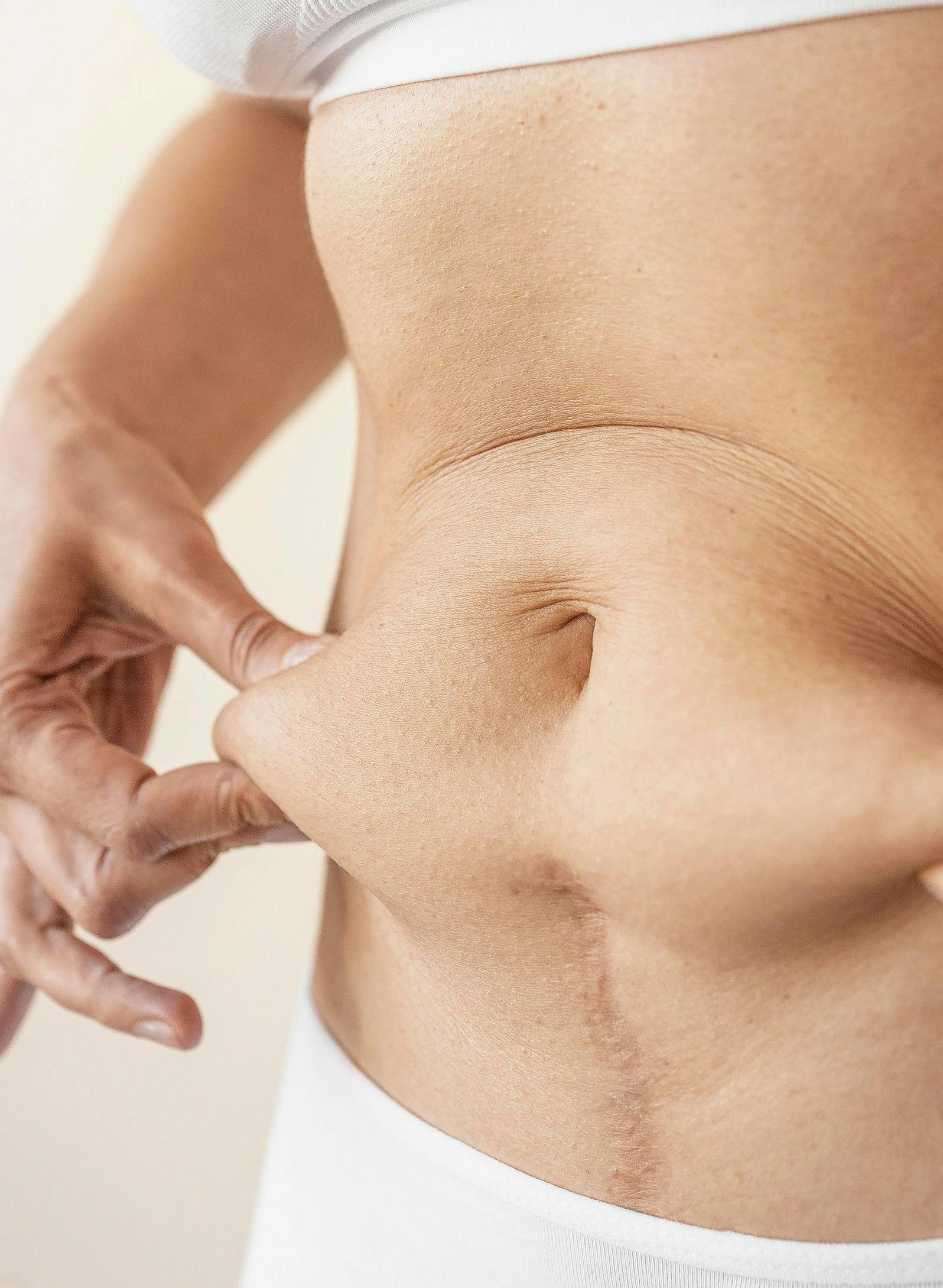 A woman holding the fat of her body around the belly area