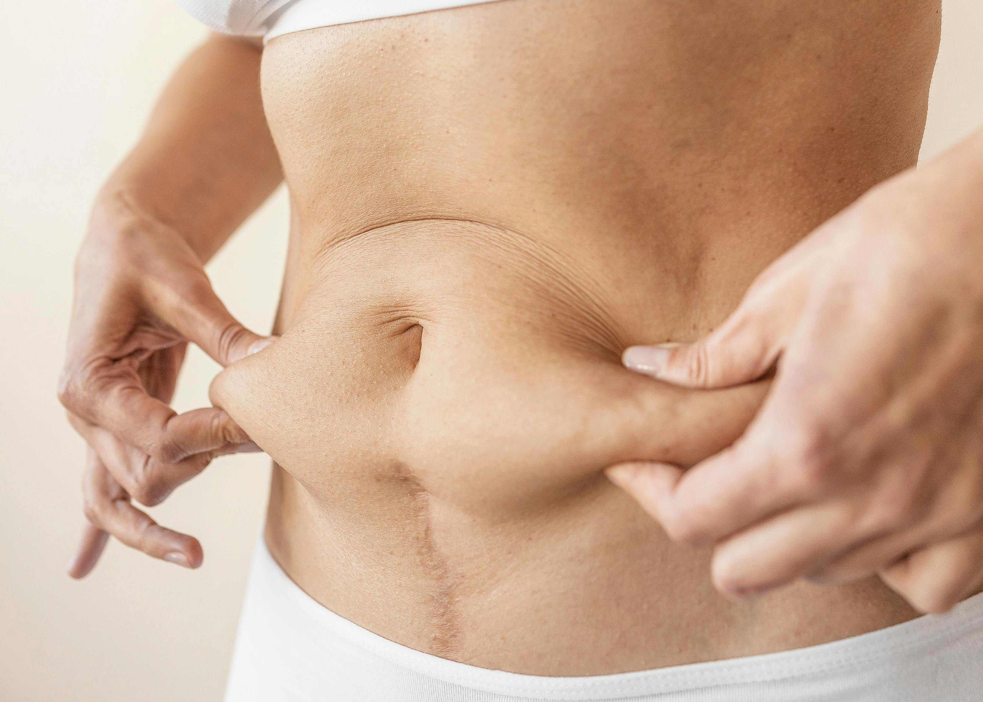 A female gripping the fat around her belly area