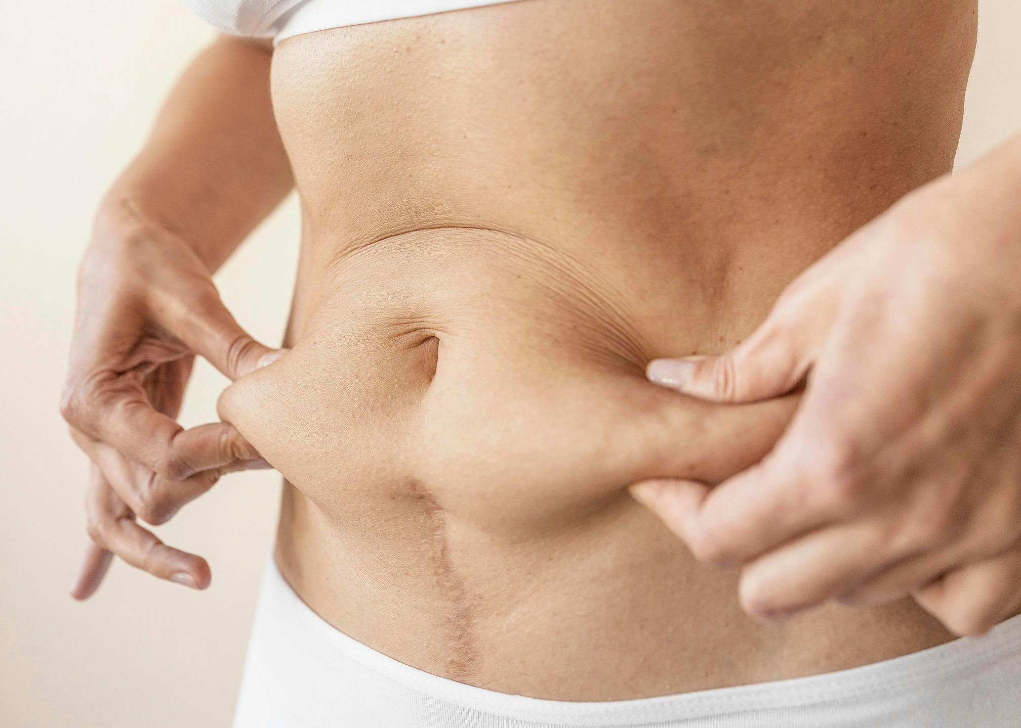 A female gripping the fat around her belly area