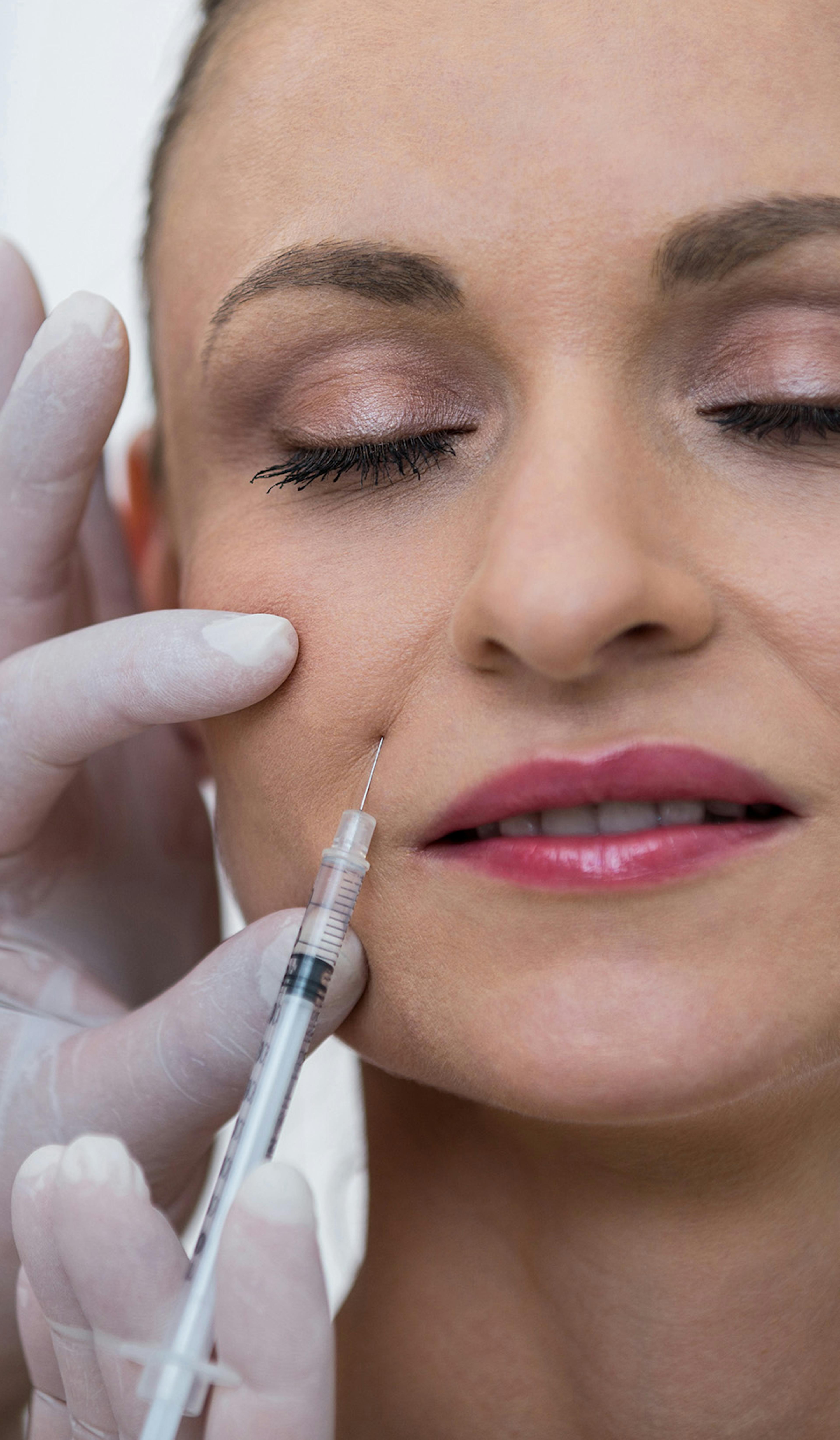A female patient receiving facial filler treatment