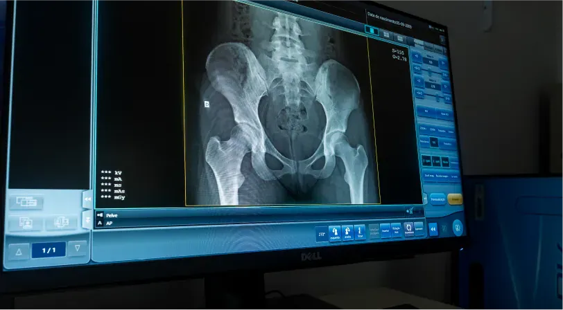 RADIOLOGIA DIGITAL