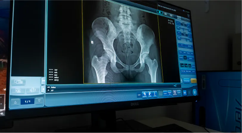 RADIOLOGIA DIGITAL