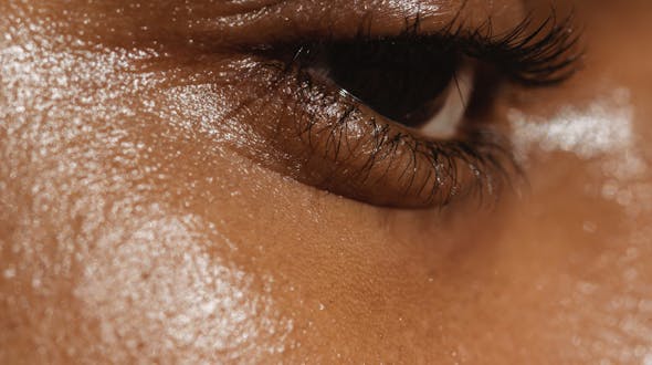 Améliorer le teint et la texture de la peau grâce au microneedling au centre de médecine esthétique CEMF Lyon Vienne