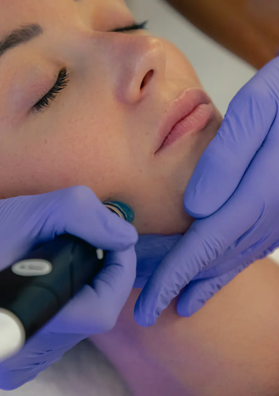 HYDRAFACIAL : Le secret d’une peau de bébé pour un glow instantané.