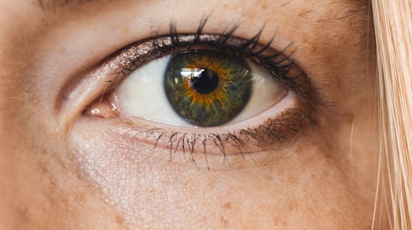 Améliorer l’aspect de la peau grâce au peeling biorevitalisant PRX T-33 au CEMF Lyon Vienne