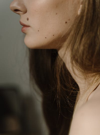 La Jawling Contouring : redéfinir la forme du visage et de la mâchoire grâce à l'acide hyaluronique au centre de médecine esthétique et laser CEMF Lyon Vienne de la Clinique Trénel