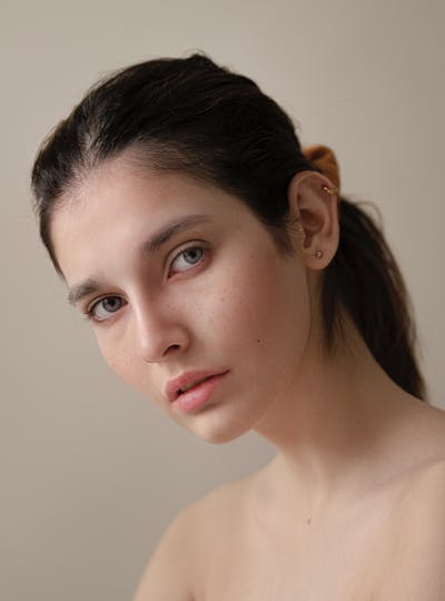 Restaurer les volumes perdus du visage suite au vieillissement grâce au lipofilling du visage au centre de médecine esthétique et laser CEMF Lyon Vienne de la Clinique Trénel