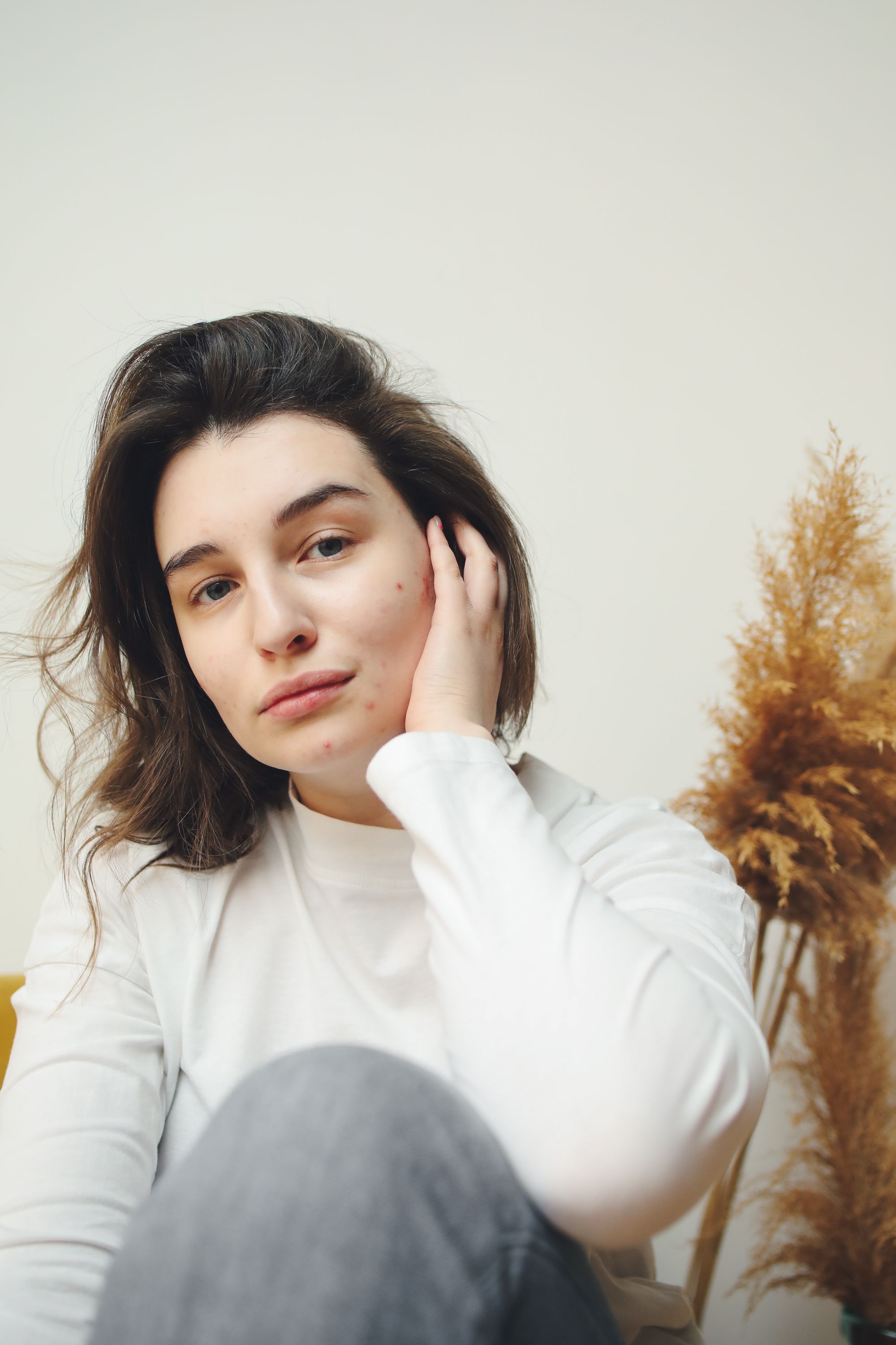Les bienfaits sur la peau grâce à la Radiofréquence Microneedling