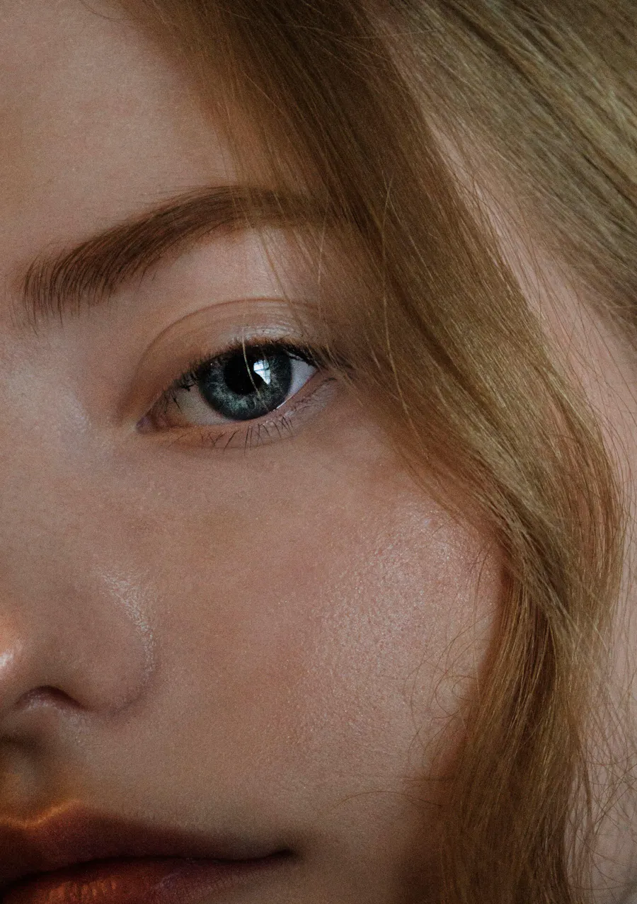 Microneedling : tout savoir sur ce traitement !