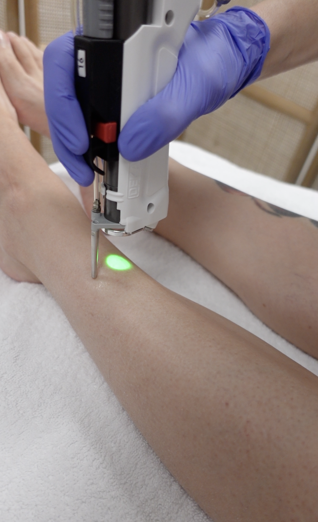 Professionnelle qui réalise une séance d'épilation laser sur les jambes d'une femme. 