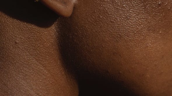 La Jawling Contouring : redéfinir la forme du visage et de la mâchoire grâce à l'acide hyaluronique au centre de médecine esthétique CEMF Lyon Vienne