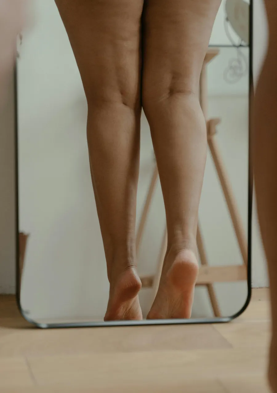 cellulite sur les jambes de femme 