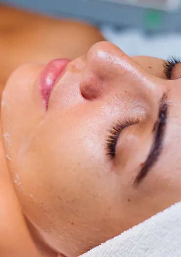 peeling chimique du visage | conseils d'experts CEMF