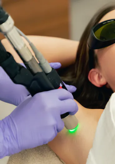 Prix de l'épilation laser au CEMF Lyon-Vienne : tarifs par zone