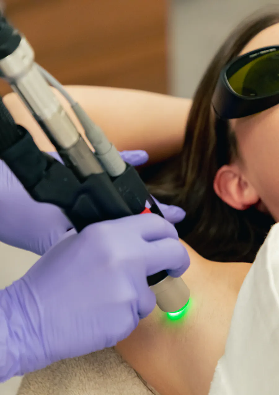 Prix de l'épilation laser au CEMF Lyon-Vienne : tarifs par zone