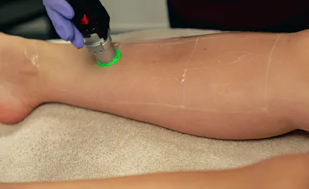 Épilation laser : pourquoi l’automne est la saison idéale pour débuter ?