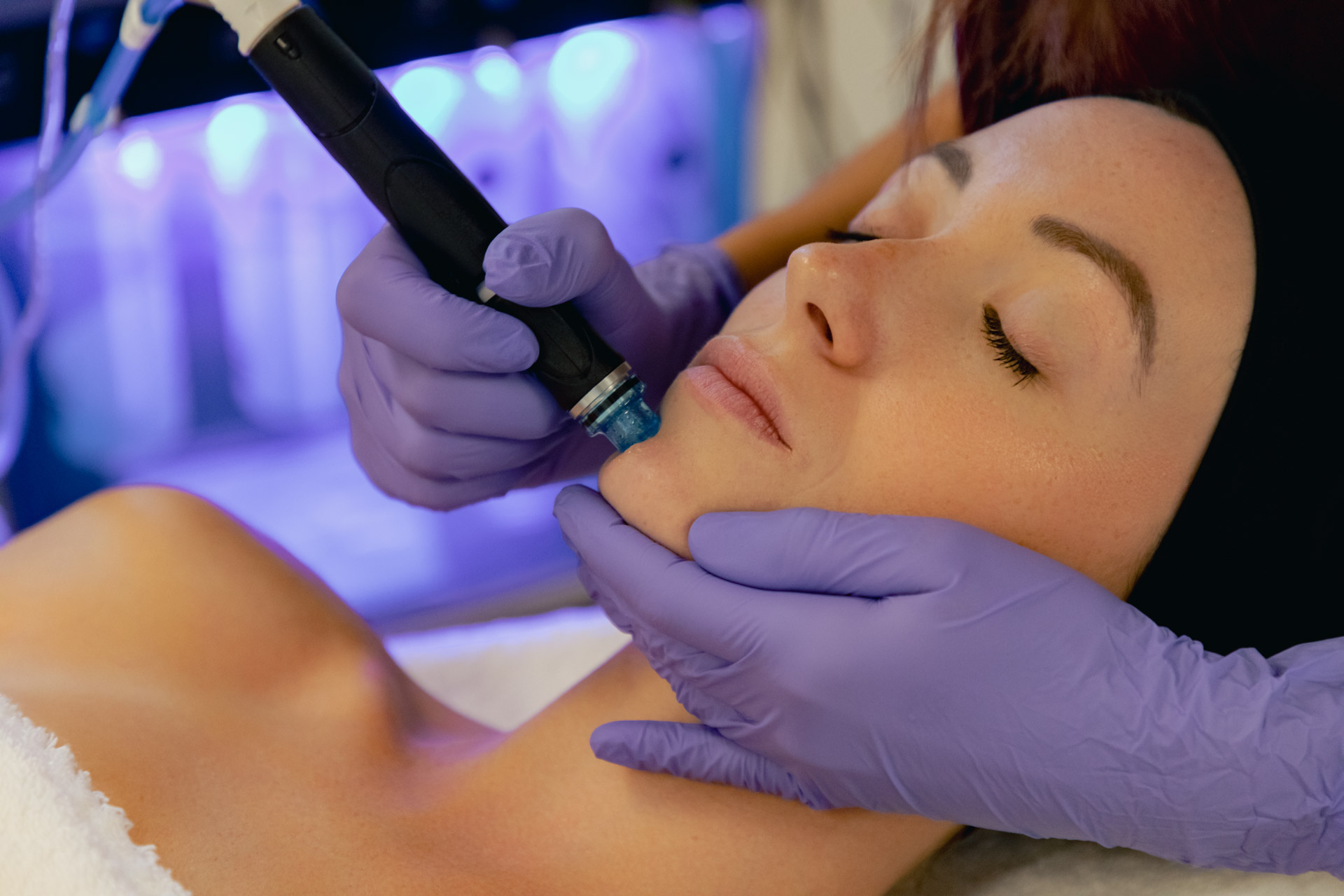 soin hydrafacial au CEMF 