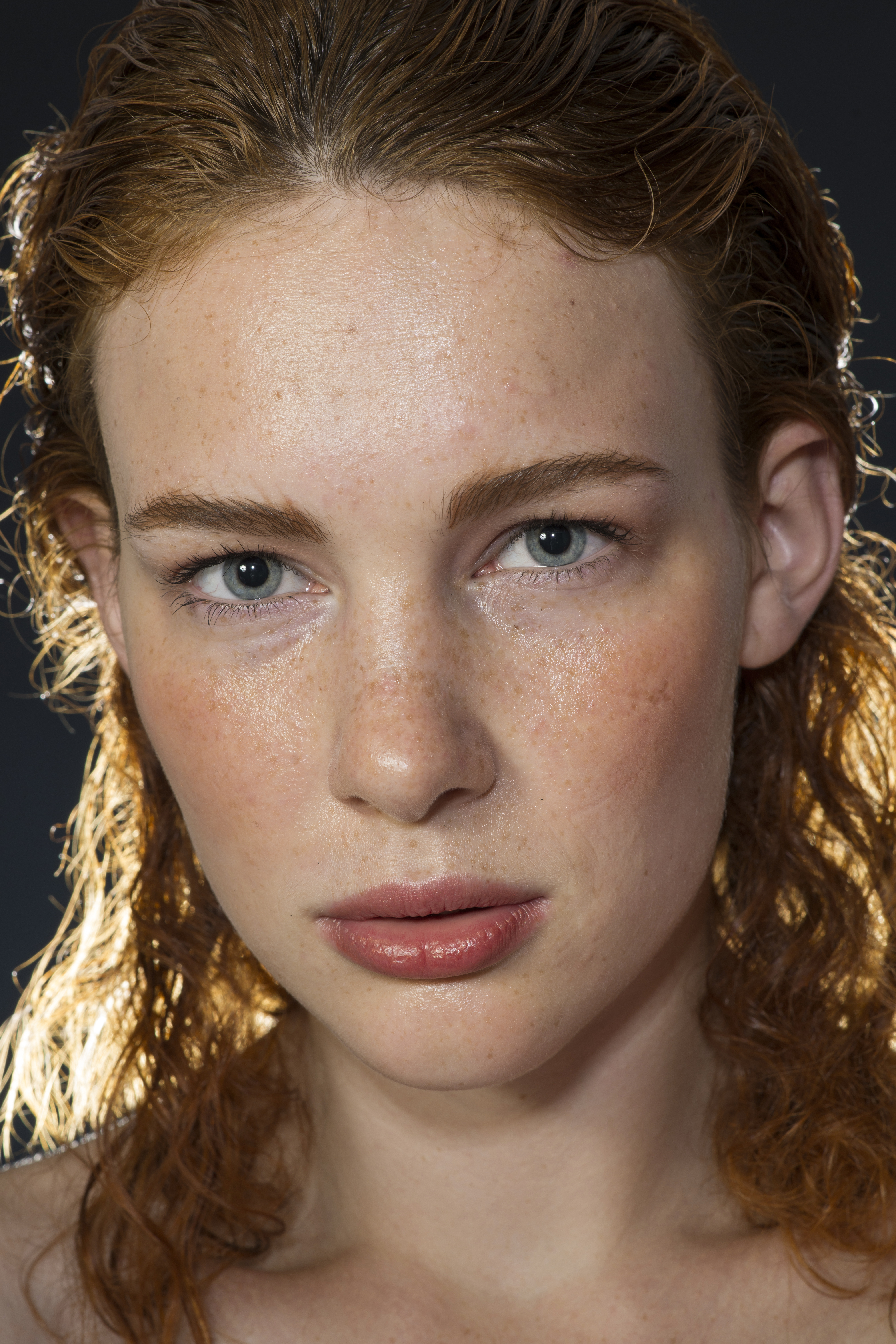 traitement contre les cernes bleus | CEMF