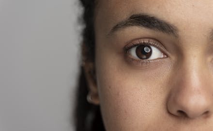 traitement pour les cernes et conseils au CEMF à Lyon et Vienne