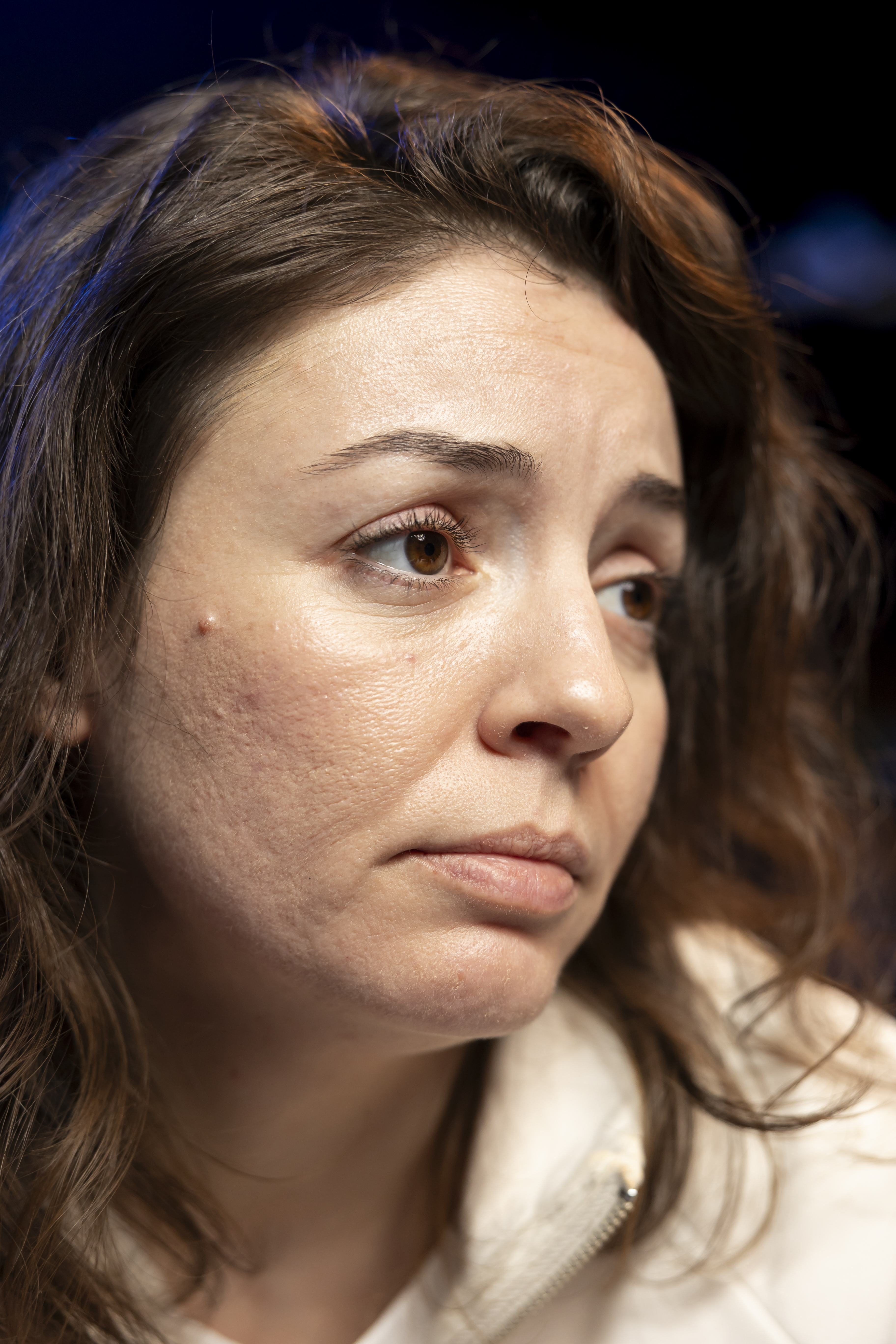 soin contre les cicatrices d'acné | CEMF