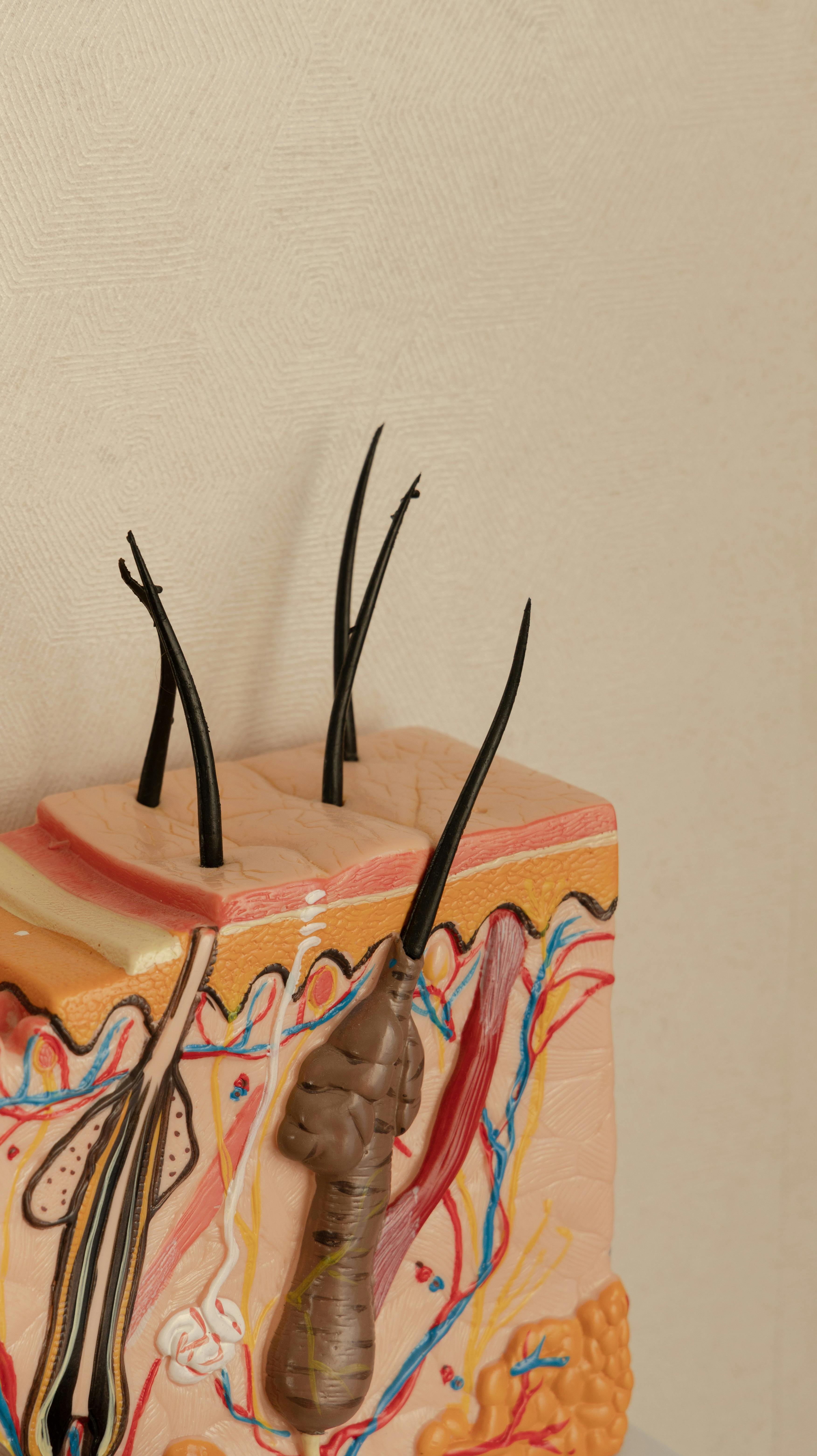 Combien de séances nécessaires pour avoir de bons résultats suite à de la mésothérapie capillaire 