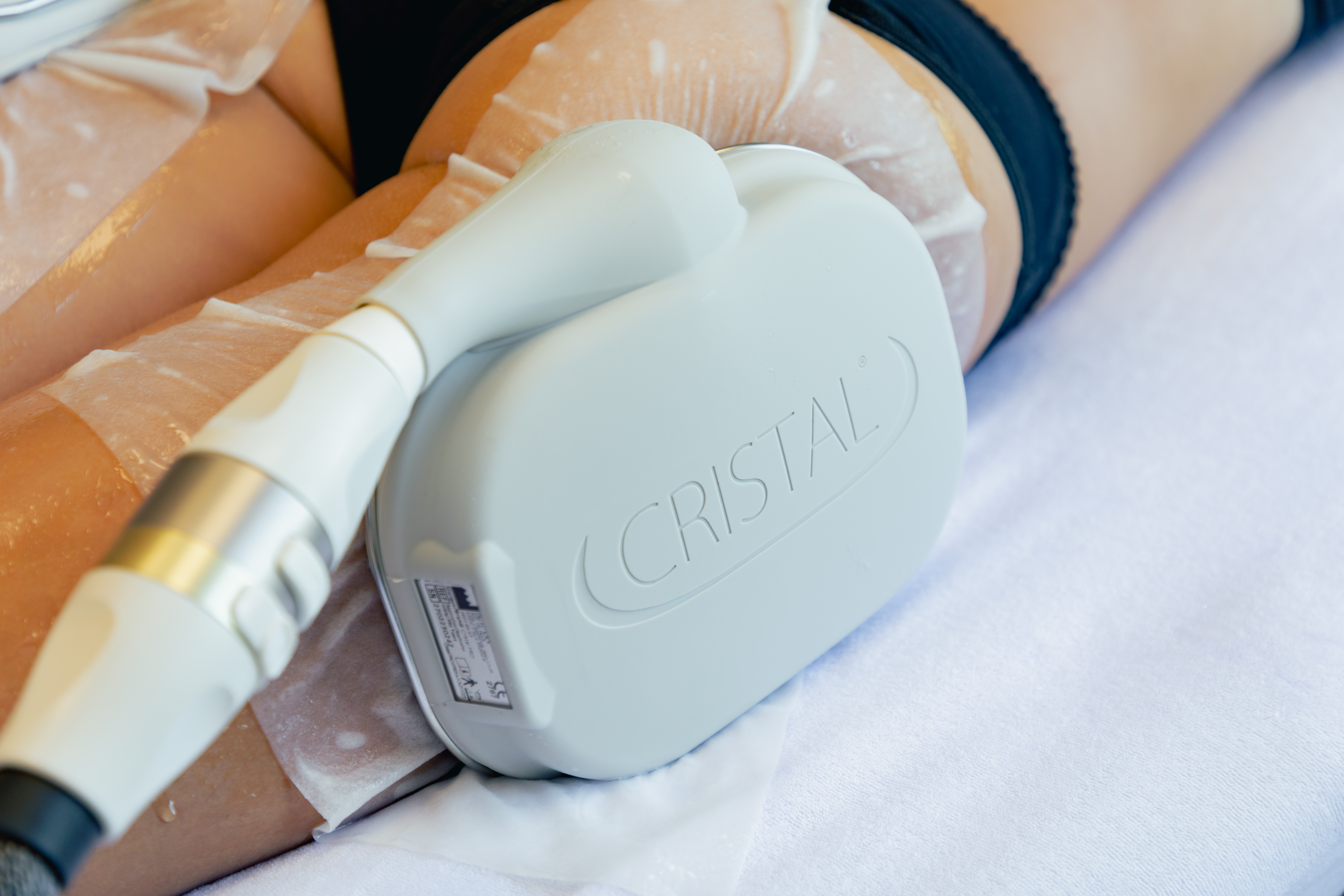 cryolipolyse 